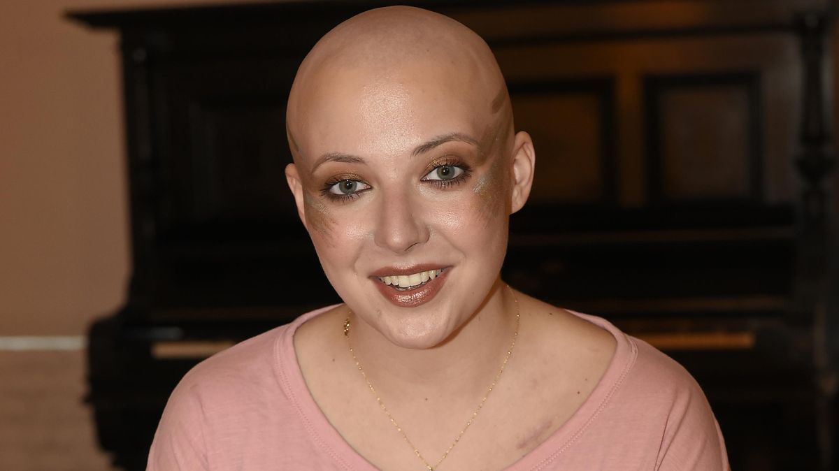 Velká modřina a jizva u klíční kosti: Anička Slováčková ukázala, co jí pomáhá v boji s rakovinou