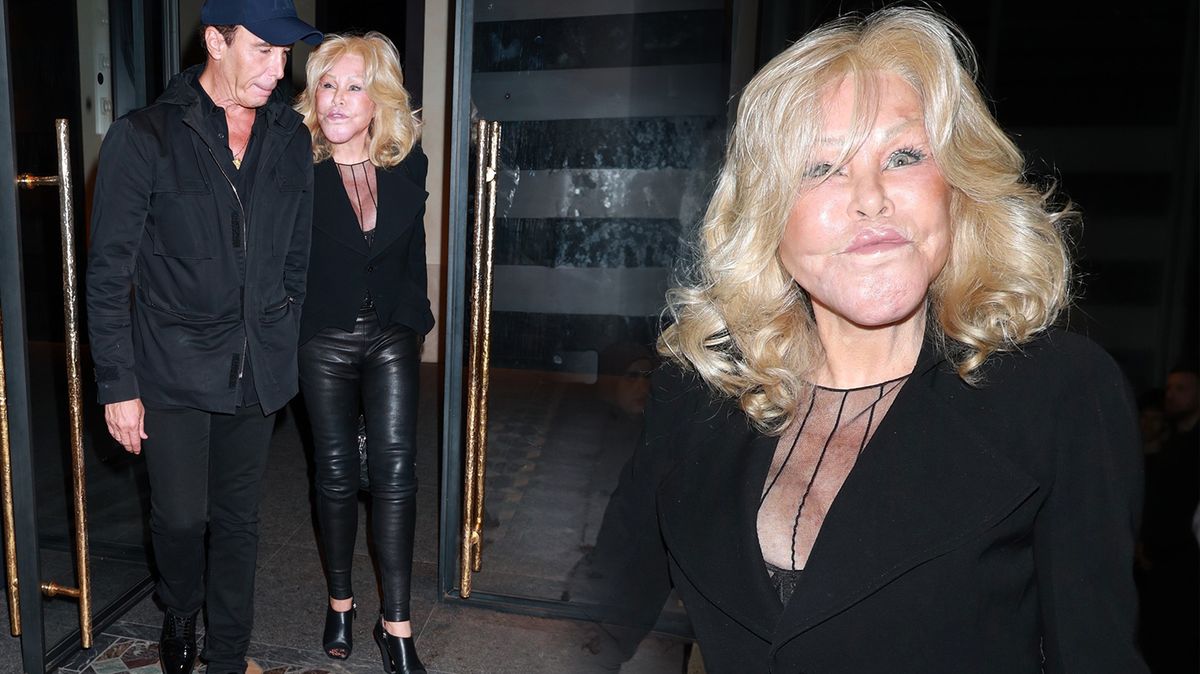 Zpackanou plastiku neřeší. Kočičí žena Jocelyn Wildenstein si vyšla na romantickou večeři se snoubencem