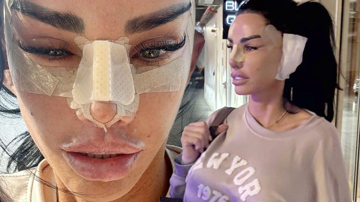 A je to tady: Katie Price spatřena po dalších zákrocích. Do Turecka si jela kromě uší a očí i pro nový nos