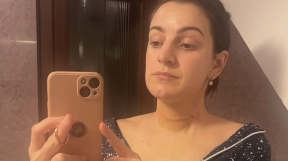 Genny Ciatti ukázala obří jizvu po operaci páteře. Zpěvačka je z nemocnice doma