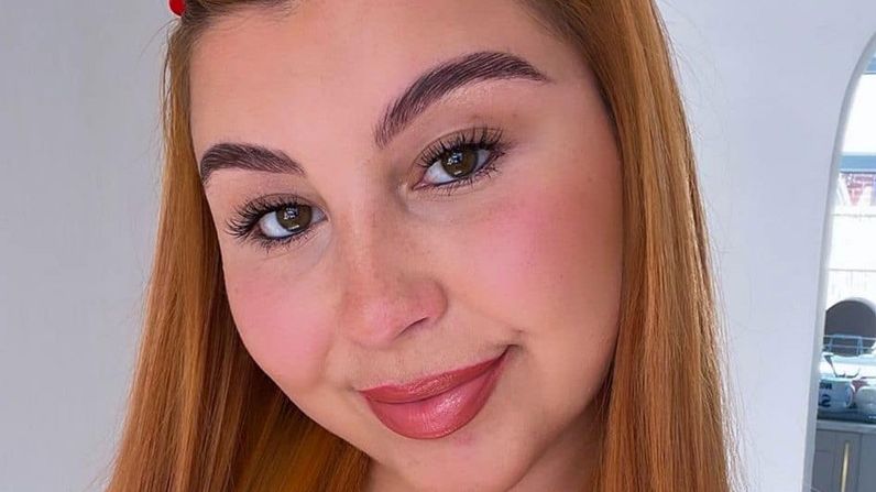 Britka chtěla jen krásnější rty, skončila s obří nateklou pusou: Přítel se vyděsil, máma jí řekla, že je ošklivá