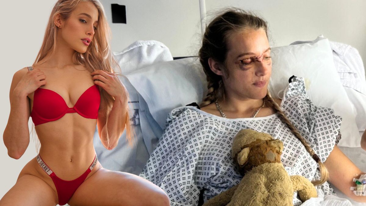Modelka s diplomem z neurovědy si na OnlyFans vydělala miliony. Pak se střetla s holubem a ztratila paměť