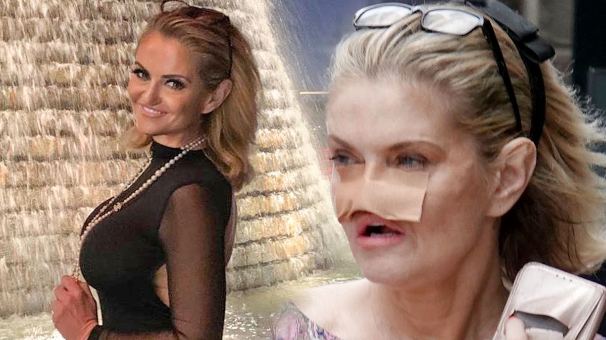Herečka, které se kvůli drogám rozpadal nos, touží po velkém comebacku. Danniella Westbrook neuvěřitelně prokoukla