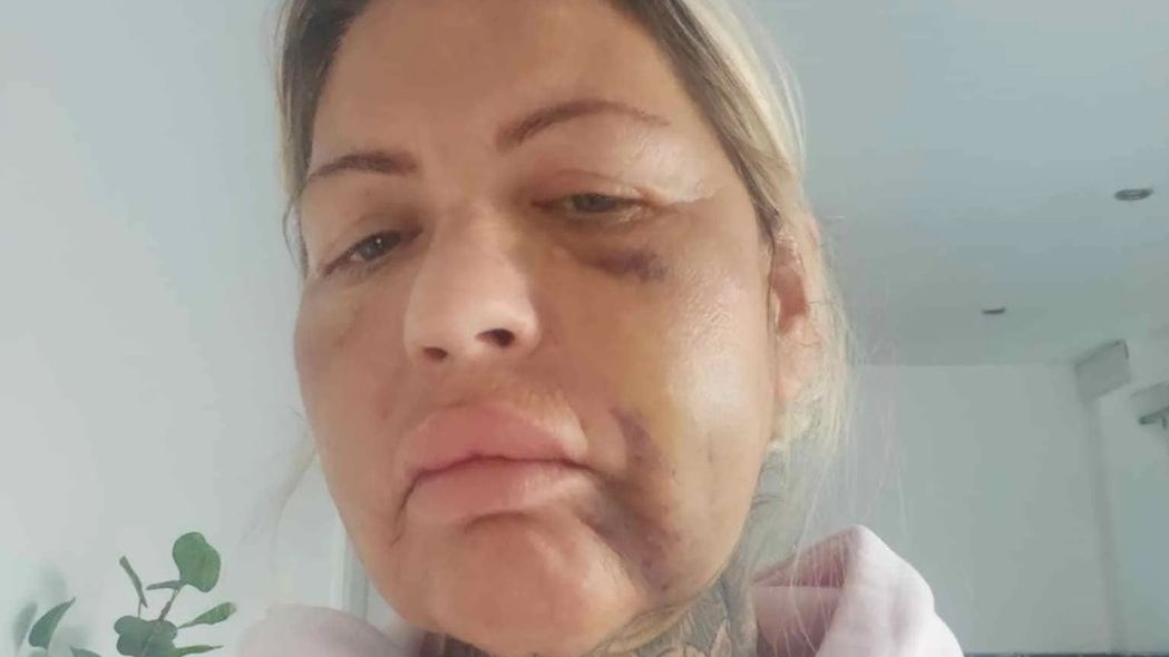 Zuby za 300 tisíc a půl roku pekla: Slib dokonalého úsměvu se matce tří dětí krutě vymstil