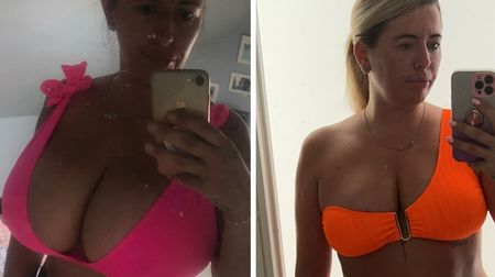 Svá prsa téměř neunesla a všichni na ně civěli: Ženě se po zmenšení o 6 velikostí změnil život. Bikiny si konečně užívá!