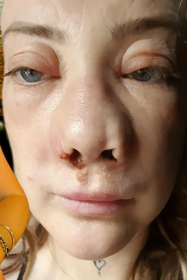 Hollywoodský úsměv z Turecka se změnil v noční můru: Maminka skončila bez zubů, znetvořená a v ukrutných bolestech - fotka 1/1