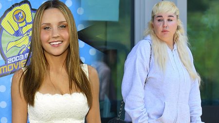 Je tak těžké uvěřit, že je to ona. Amanda Bynes dál děsí fanoušky vizáží. Teď se odhodlala k nebezpečnému kroku
