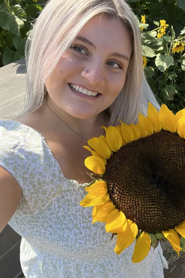 Američance natekl obličej tak, že vypadala jako E.T. Způsobilo to něco, čemu se v létě vystavujeme téměř denně   - fotka 1/1