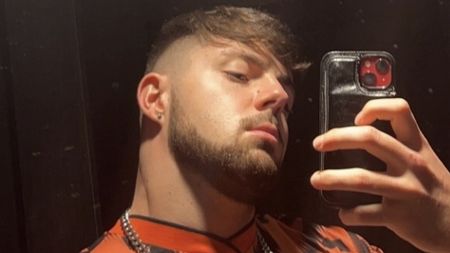Influencer ignoroval přísný zákaz sexu po transplantaci vlasů: Hořce toho litoval 
