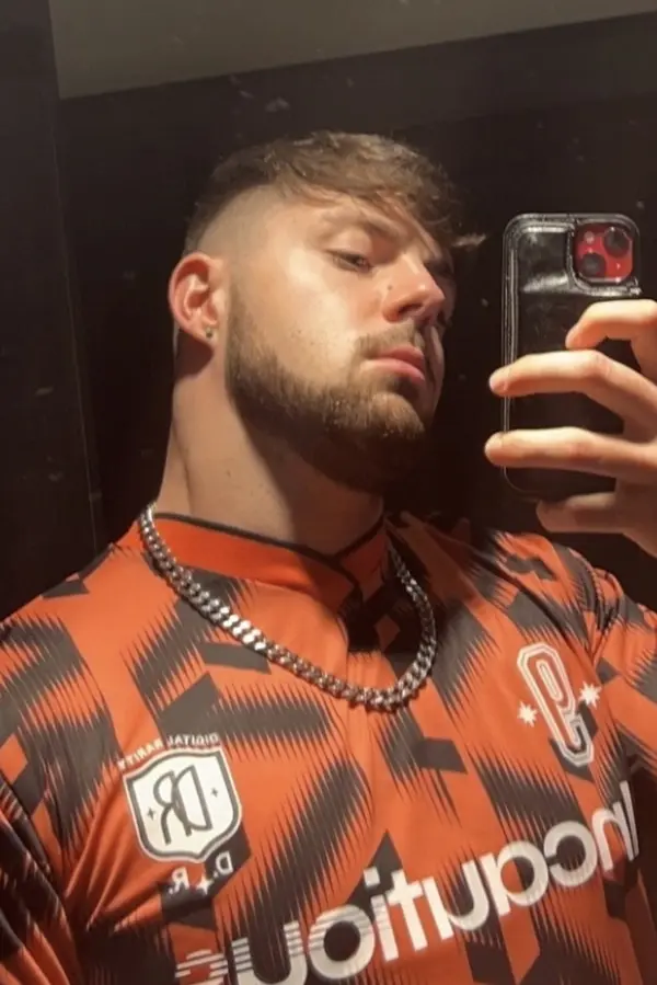 Influencer ignoroval přísný zákaz sexu po transplantaci vlasů: Hořce toho litoval  - fotka 1/1
