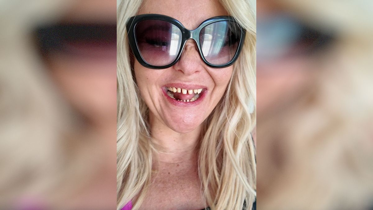 Závislost na alkoholu řešila dvojnásobná matka ketaminem a málem přišla o zuby. S novým chrupem je k nepoznání