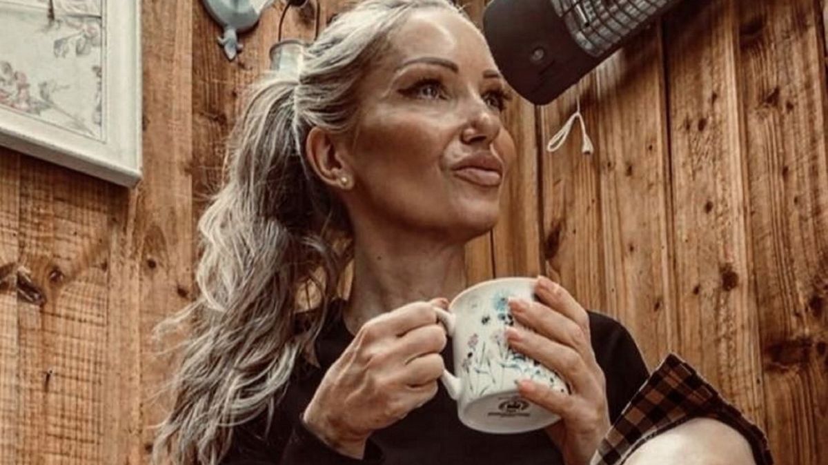 Tipnete si, kolik je téhle kočce doopravdy let? Stačí jí Love Island, SPF 50, mladá parta a trochu botoxu do čela