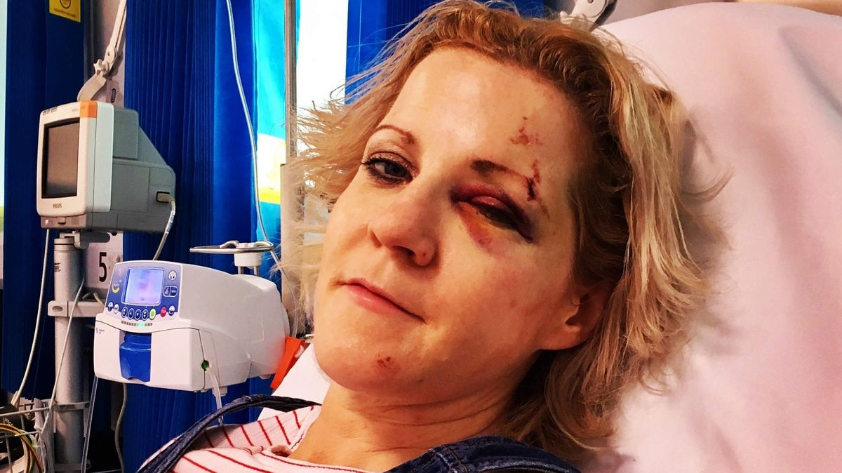 Žena sedmkrát o vlásek unikla smrti, přesto ji vlastní konec neděsí: Už se nebojím vůbec ničeho, říká