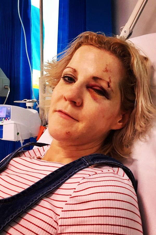Žena sedmkrát o vlásek unikla smrti, přesto ji vlastní konec neděsí: Už se nebojím vůbec ničeho, říká  - fotka 1/1