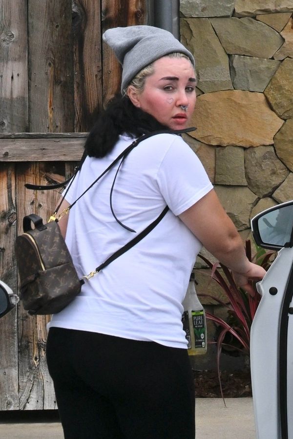 Amanda Bynes si „zvyšuje sebevědomí“. Teď se pochlubila svým vzhledem po kosmetickém zákroku. Fanoušci posílají modlitby - fotka 1/1