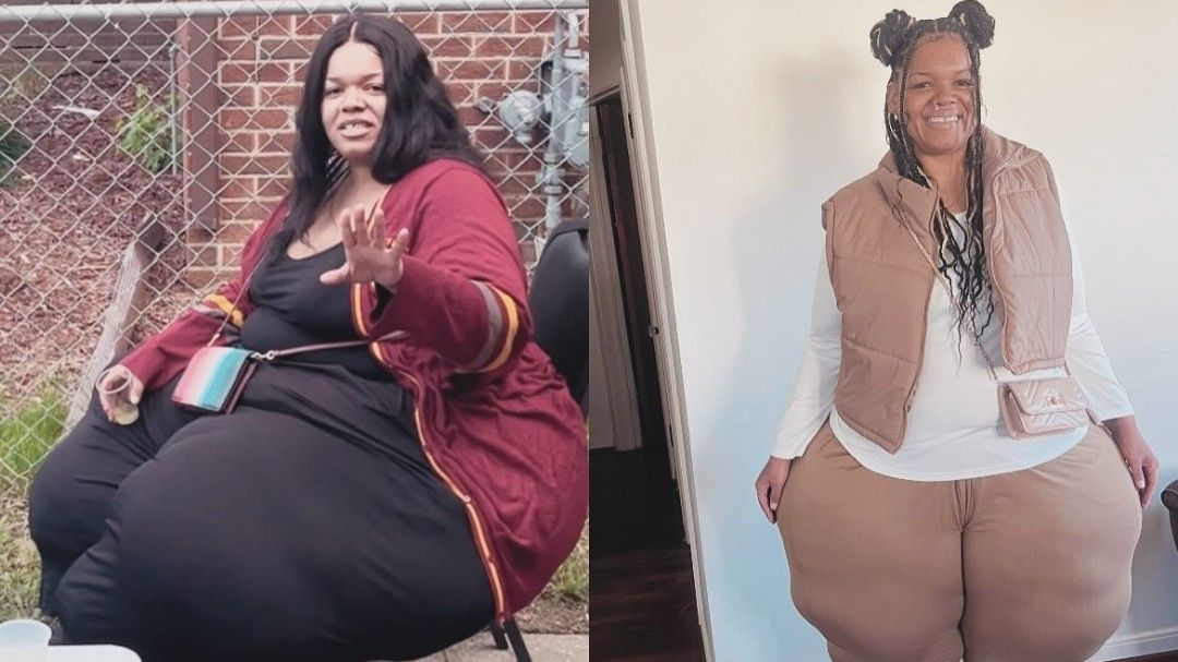 Žena vážila 325 kilo a nevěděla, co se sebou: Lékaři radili, ať jí méně a hýbe se, šlo ale o chybnou diagnózu