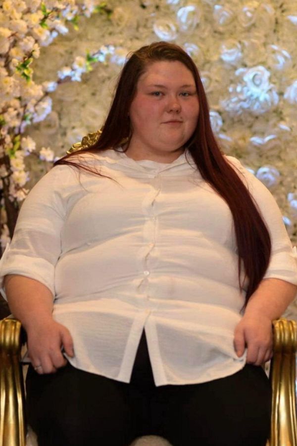 Dívka závislá na brambůrkách pět let neopustila dům: Tajně se přejídala v pokoji a projedla se ke 171 kilům  - fotka 1/1