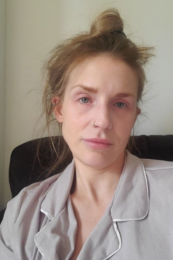 Žena po 28 letech nechala pití. Po dvou měsících abstinence vypadá neuvěřitelně  - fotka 1/1