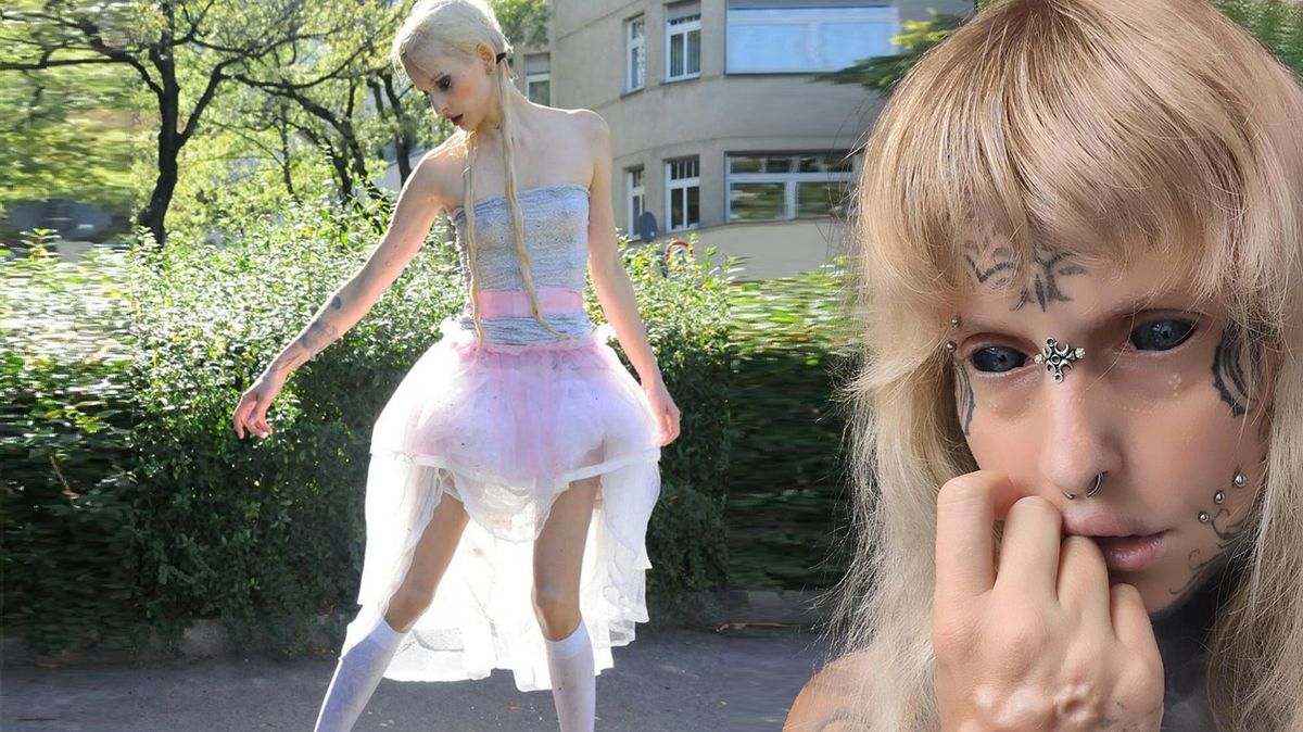 Má potetované oční bělmo i implantát lebky na ruce a diví se, že na ni všichni zírají. Přitom bývala tak krásná!