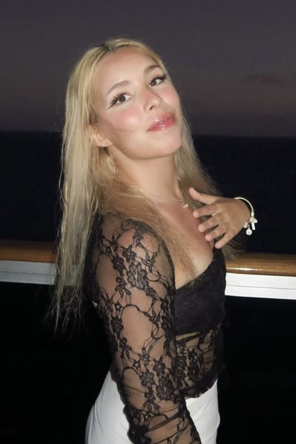 TikTokerka skončila po vyplnění rtů v bolestech a neschopná jíst: Musíte to prostě vydržet, radí teď druhým - fotka 1/1