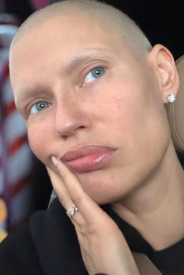 S rakovinou bojující modelka Victoria’s Secret se opět toužila stát součástí ikonické přehlídky. Neuspěla!  - fotka 1/1