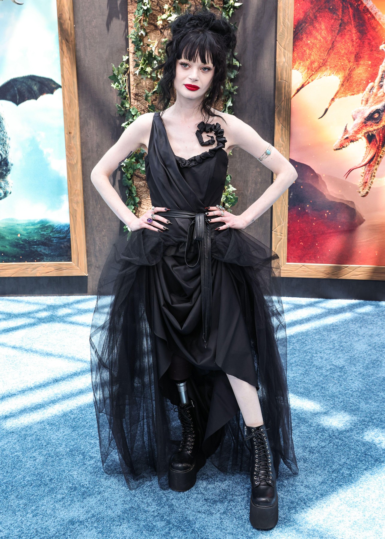 Herečka Ruth Codd podstoupila amputaci obou nohou pod koleny