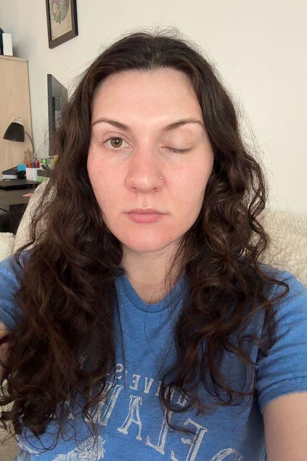 Vsadím se, že můj den je horší než ten váš, napsala influencerka, které po botoxu ochrnulo víčko, a ukázala fotky - fotka 1/1