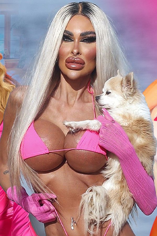 5 žen posedlých Barbie vzhledem, které nic nezastaví: Infekce, dětský olej jako výplň ani hnijící maso je neodradily - fotka 1/1