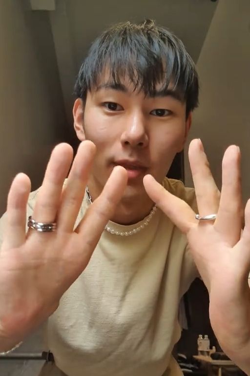 Muž se narodil bez palců na rukách a popsal, jak se mu žije: Zvládám všechno kromě jedné věci, říká - fotka 1/1