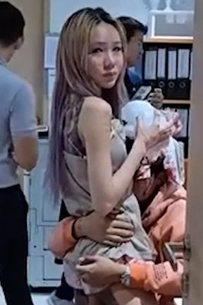 VIDEO: Krásou posedlá dívka (18) pořezala přítele na hlavě: Omylem se dotkl jejího operovaného nosu!