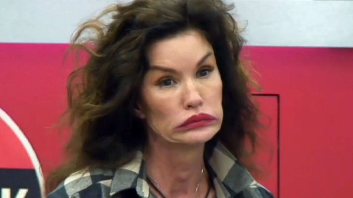 První supermodelka světa žaluje TV o miliony: Při natáčení si nevratně zničila obličej. Zhyzdila ses plastikami! Míní lidé