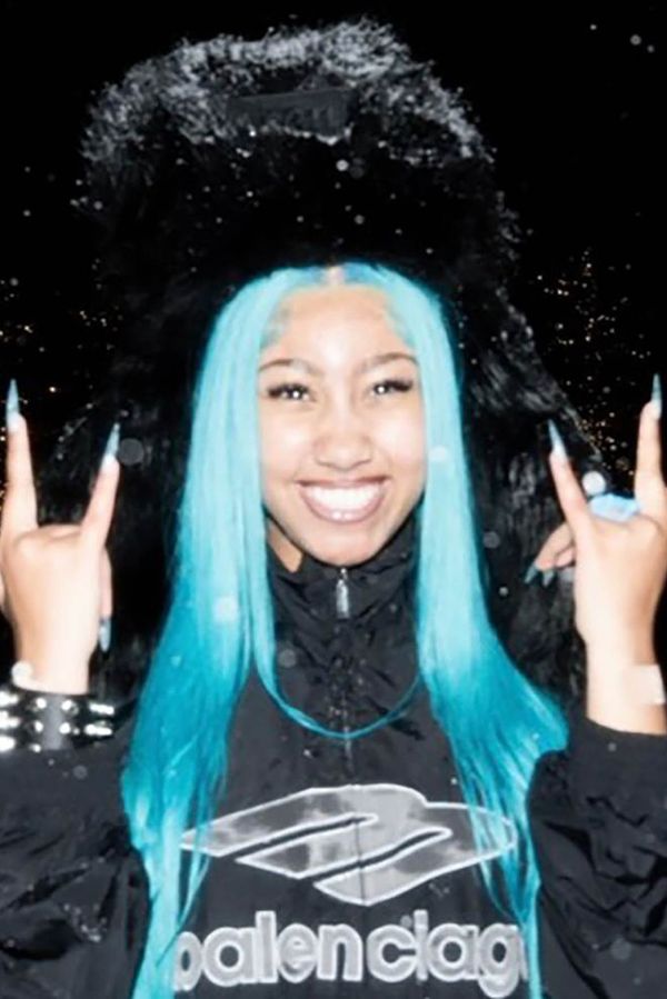 Za piercing v prstu přišla lavina kritiky. Dcera Kim Kardashian ho sundala. Teď má diamantové zuby a piercing mezi očima - fotka 1/1