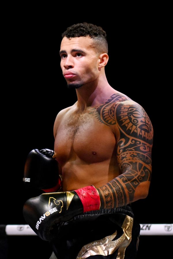 Influencer za úplatu vytetoval fanouškovi své jméno na čelo: Dopadlo to příšerně. Tipnete si, kolik ho to stálo? - fotka 1/1