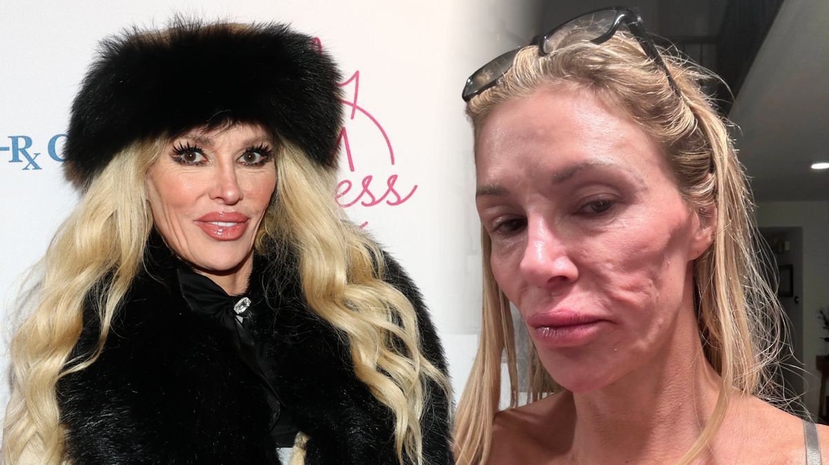 Deformace obličeje, otoky a pohyby pod kůží: Televizní hvězda trpící parazity našla příčinu. Na vině jsou dvě velké věci