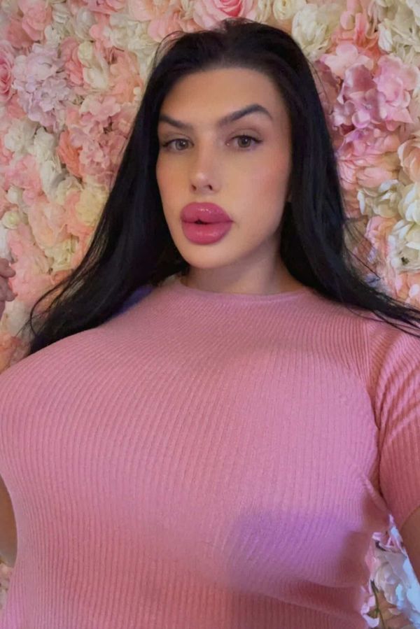 Modelka s největšími rty v Británii si nechala rozpustit výplně a ukázala rozdíl. Změna jí prospěla, ona se ale stydí  - fotka 1/1