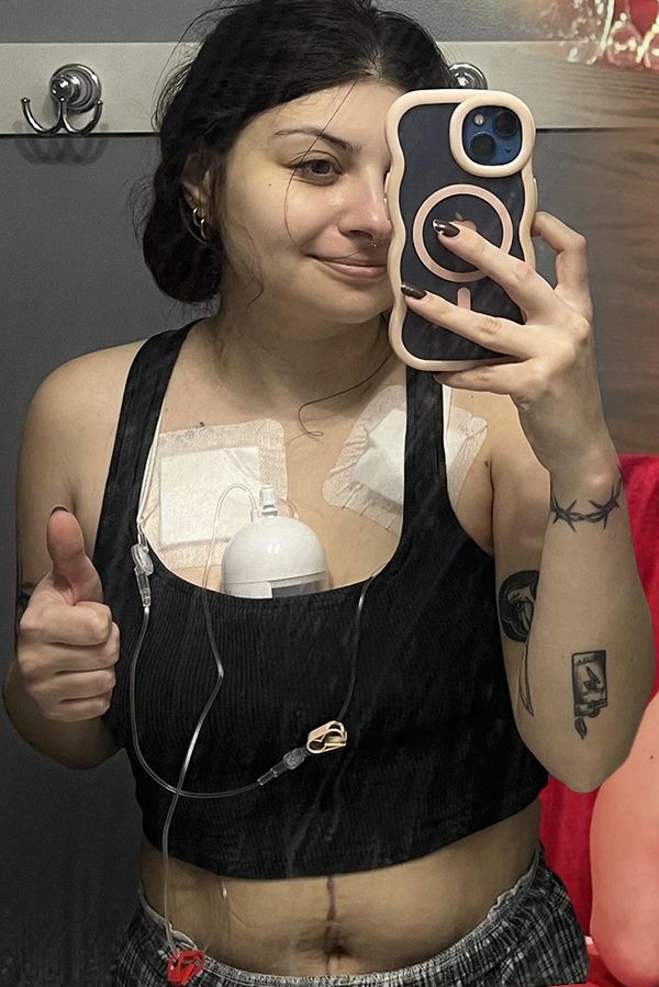 Mladá žena ignorovala varovné signály svého těla. Ve 27 letech čelí rakovině střev ve čtvrtém stadiu - fotka 1/1