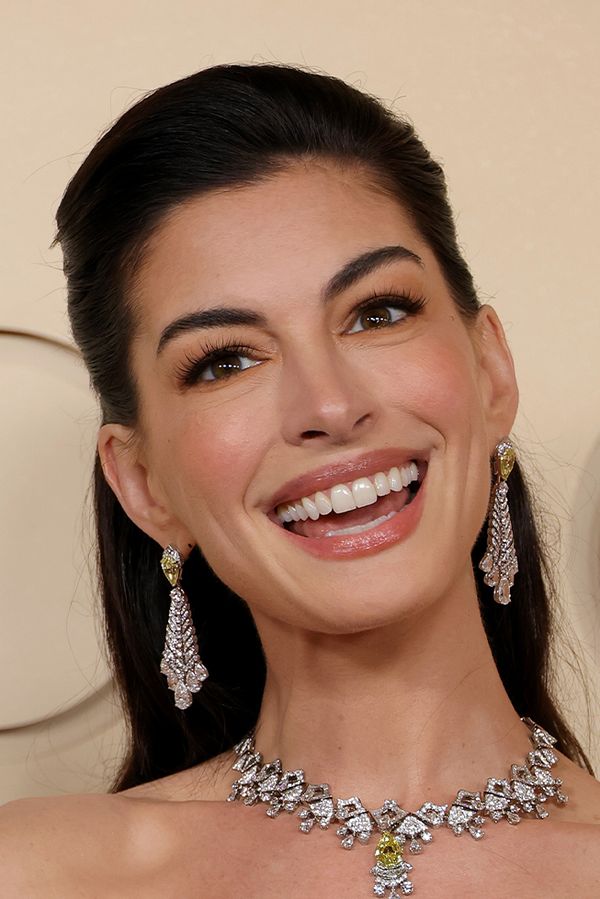 Anne Hathaway vyšla na Oscary a lidé zalapali po dechu: Co si to udělala s obličejem a proč? - fotka 1/1