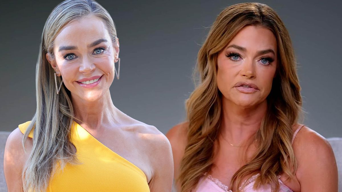Denise Richards detailně předvedla šokující změnu po faceliftu. Doktor jí ubral 20 let. Vylepšil jí i ušní lalůčky!