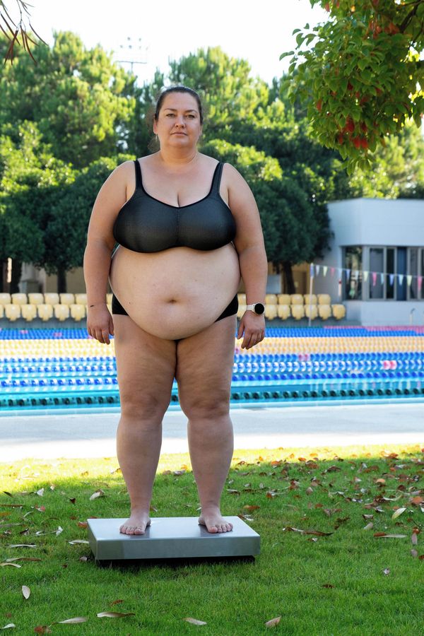 Zuzana z Extrémních proměn má 149 kilo a bojuje s roztroušenou sklerózou. Obezita má vliv i na její partnerský život - fotka 1/1