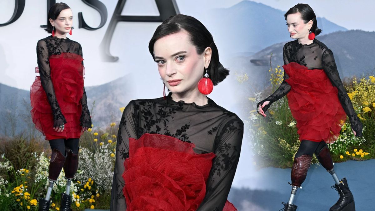 Bez obou nohou se jí žije lépe než s jednou: Herečka se zbavila utrpení. S protézami se teď vrací i k hraní