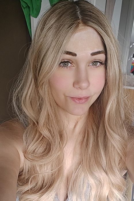 Hrůza v práci: Mladou maminku skalpoval stroj. Nepoznávaly ji ani její děti - fotka 1/1