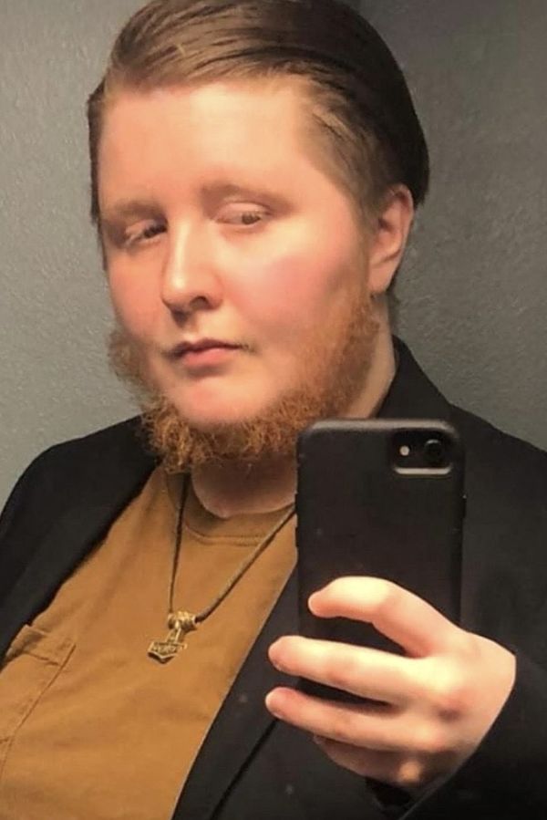 Expartneři byli znechucení a cizí lidé krutí: Tato žena si ale s bradkou připadá krásná - fotka 1/1