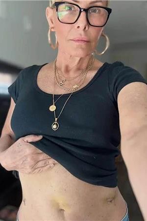 Hvězda Pobřežní hlídky bojuje s rakovinou: Nemoc se šířila dál, herečka ukázala jizvy na břiše po vážné operaci - fotka 1/1