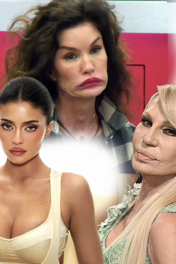 Celebrity, které ztratily svou tvář. Po plastikách jsou někým jiným - fotka 1/1