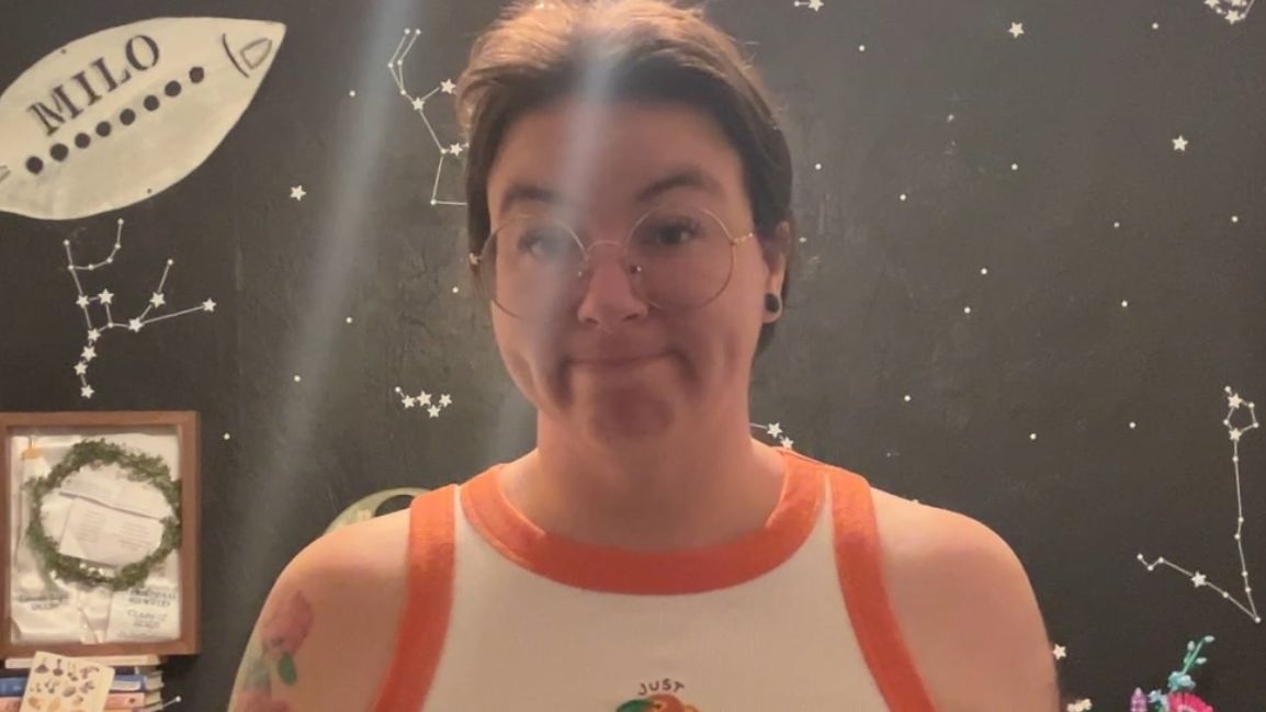 Konečně se může nadechnout! Žena si nechala z poprsí velikosti G odstranit 2 kg tkáně. Stálo ji to 281 tisíc