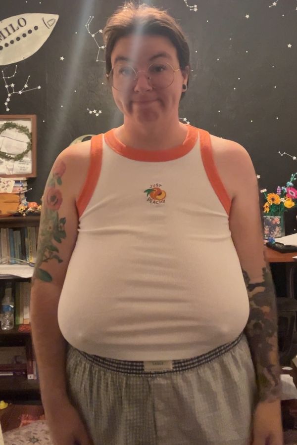 Konečně se může nadechnout! Žena si nechala z poprsí velikosti G odstranit 2 kg tkáně. Stálo ji to 281 tisíc  - fotka 1/1