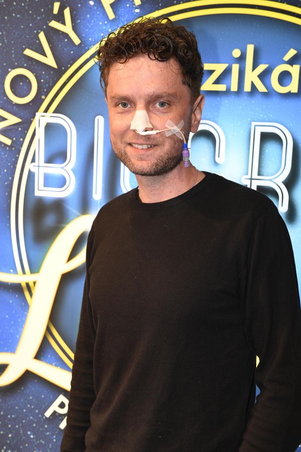 Z tiskové konference na operační sál: Muzikálový zpěvák je k nepoznání. Vyděsil sondou v nose i vyhublou postavou - fotka 1/1
