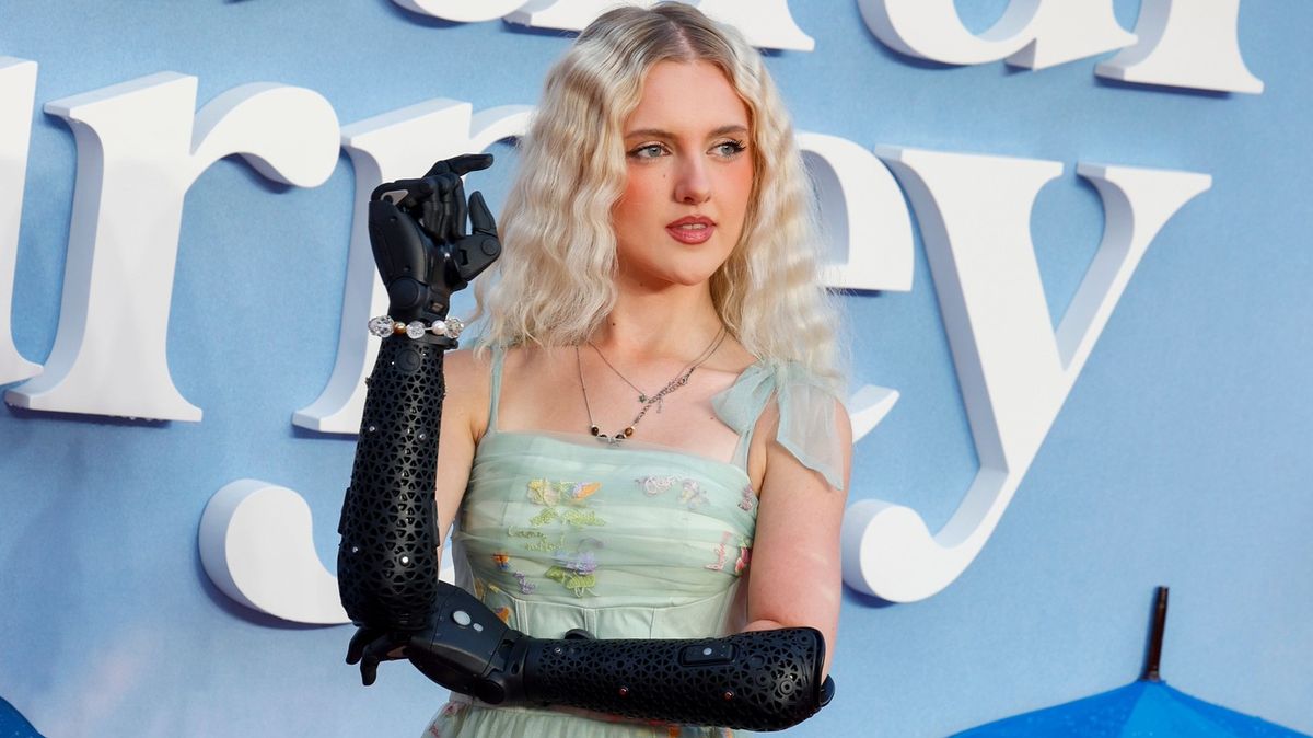 Jako dítě prodělala meningitidu a přišla o obě ruce: Na tohle byste si měli dát pozor, vzkazuje dívka