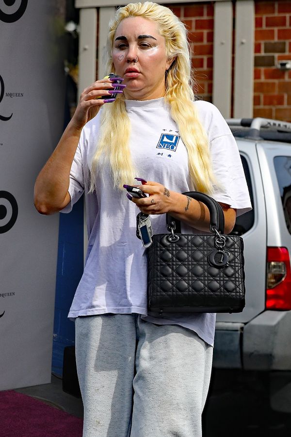 Někdejší hvězda Amanda Bynes prošla obrovskou změnou. A došlo i na obočí! Fanoušci jsou překvapeni - fotka 1/1