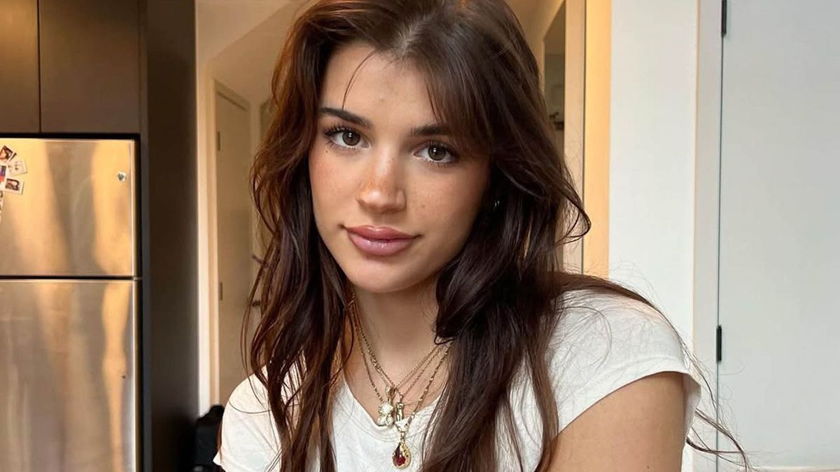 Pětadvacetiletá influencerka šokovala částkou za plastiky: Nevypadám takhle zadarmo, přiznala